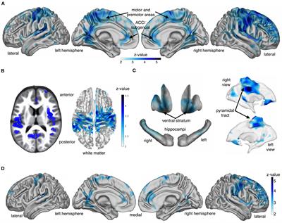 Testing hypotheses about the harm that capitalism causes to the mind and brain: a theoretical framework for neuroscience research